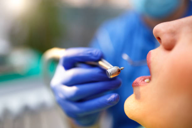 Dental Bonding in Cleveland, MS